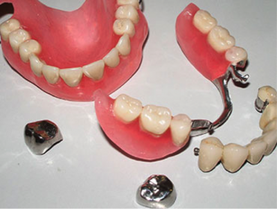 Виды Протезов Зубов Фото